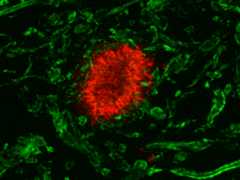 encefalopatie spongiformi