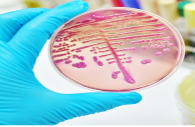 img STEC: ETICHETTATURA E COMUNICAZIONE DEL RISCHIO