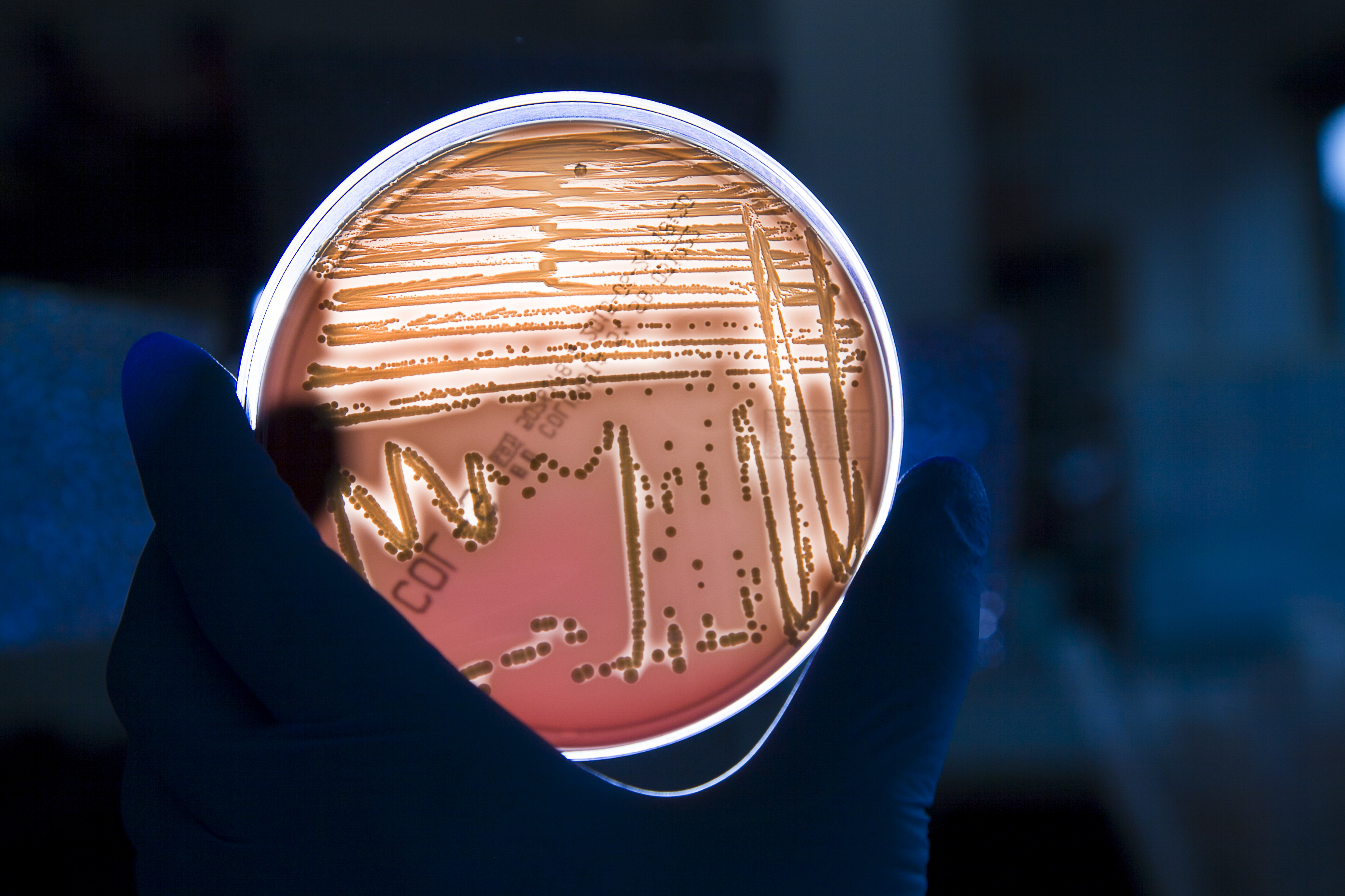 test di autovalutazione sui microrganismi negli alimenti